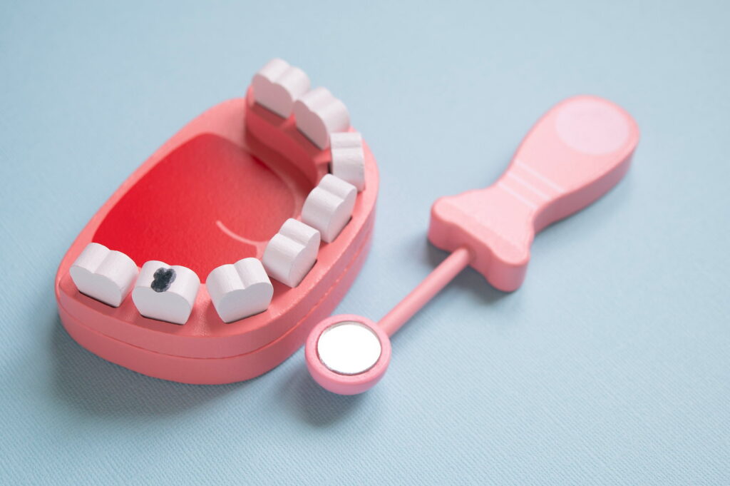I Think I Have a Cavity, Can I Get Treatment?