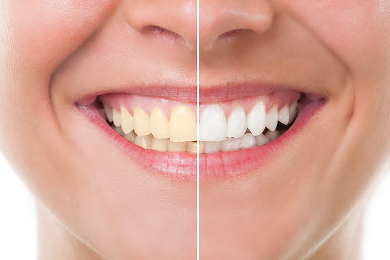 Dentist in Bastrop