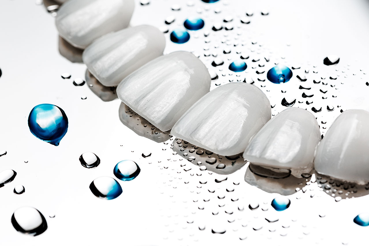 Veneers in Bastrop, TX: What to Know Before Transforming Your Smile