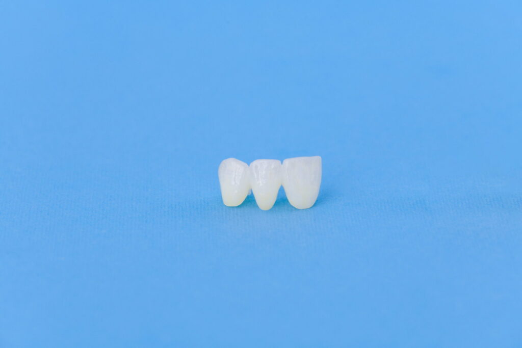 Why Are Dental Crowns Important, and Which Dentist Can Treat Me